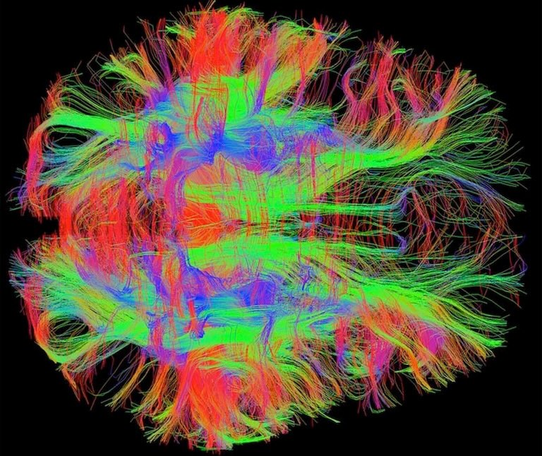 Brain